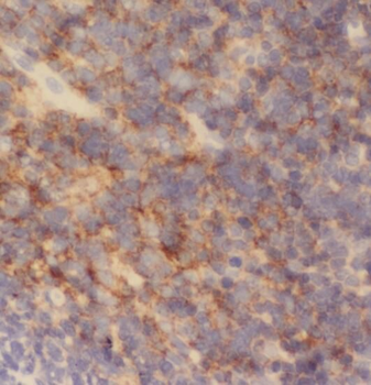 RAD51D Rabbit Polyclonal Antibody