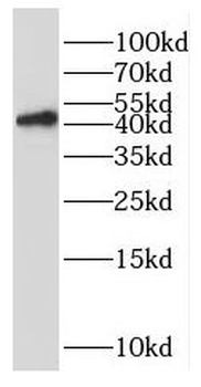 RAD51B Rabbit Polyclonal Antibody
