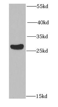 RAD9A Rabbit Polyclonal Antibody
