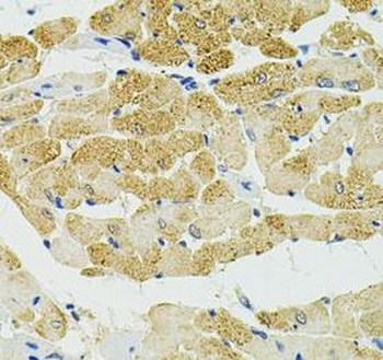 RALBP1 Rabbit Polyclonal Antibody