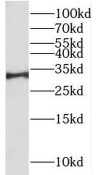 RALYL Rabbit Polyclonal Antibody