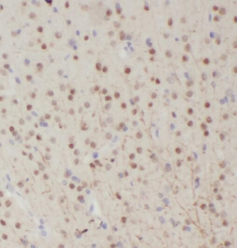 RALYL Rabbit Polyclonal Antibody