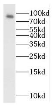 RANBP9 Rabbit Polyclonal Antibody