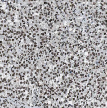 RANBP9 Rabbit Polyclonal Antibody