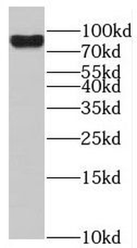 RAP1GAP Rabbit Polyclonal Antibody