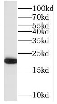 RAP2B Rabbit Polyclonal Antibody
