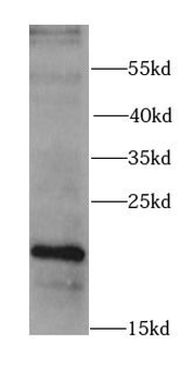 RARRES2 Rabbit Polyclonal Antibody