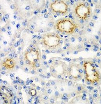 RARRES2 Rabbit Polyclonal Antibody
