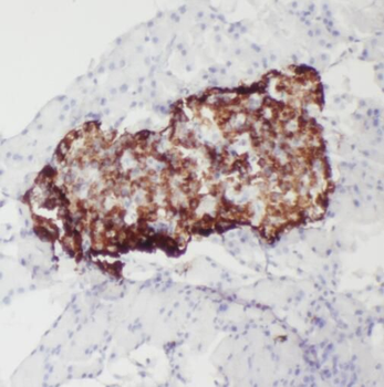 RASEF Rabbit Polyclonal Antibody