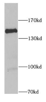 RASGRF1 Rabbit Polyclonal Antibody