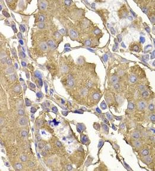 RASGRF1 Rabbit Polyclonal Antibody