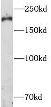 RB1CC1 Rabbit Polyclonal Antibody