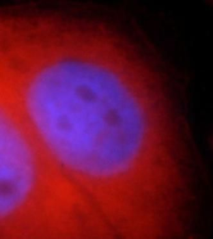 RB1CC1 Rabbit Polyclonal Antibody