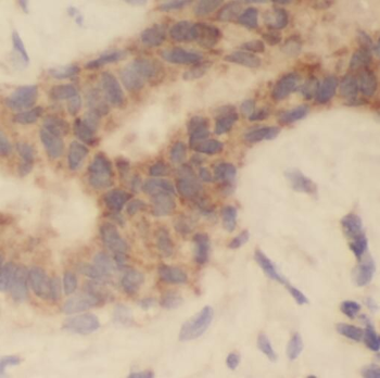 RB1CC1 Rabbit Polyclonal Antibody