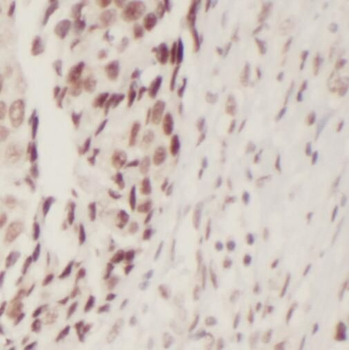 RB1CC1 Rabbit Polyclonal Antibody