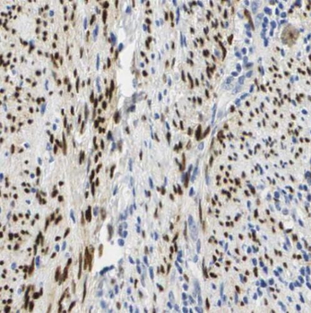 RBBP4 Antibody