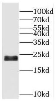 RBBP9 Rabbit Polyclonal Antibody