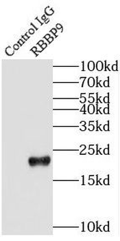 RBBP9 Rabbit Polyclonal Antibody