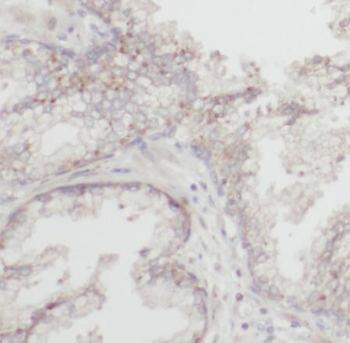 RBBP9 Rabbit Polyclonal Antibody