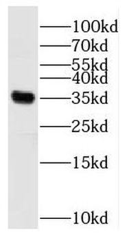 RBM11 Rabbit Polyclonal Antibody