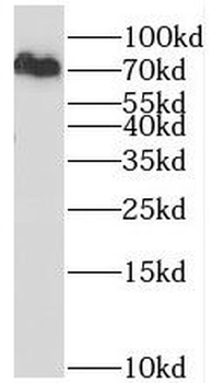 RBM14 Rabbit Polyclonal Antibody