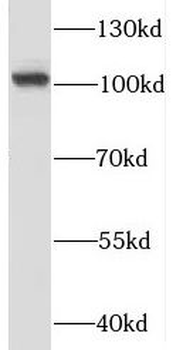 RBM15 Rabbit Polyclonal Antibody