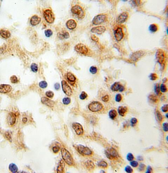 RBM15 Rabbit Polyclonal Antibody