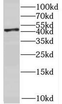 RBM17 Antibody