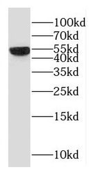 RBM22 Antibody