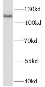 RBM25 Rabbit Polyclonal Antibody