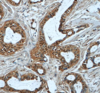 RBM25 Rabbit Polyclonal Antibody