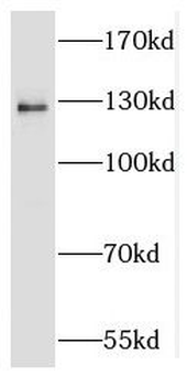 RBM26 Rabbit Polyclonal Antibody