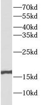 RBM3 Rabbit Polyclonal Antibody