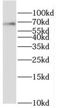 RBM42 Rabbit Polyclonal Antibody