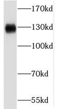 RBM6 Rabbit Polyclonal Antibody