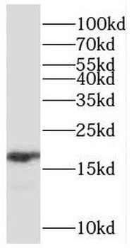 RBP1 Rabbit Polyclonal Antibody