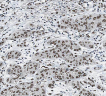 RBP1 Rabbit Polyclonal Antibody