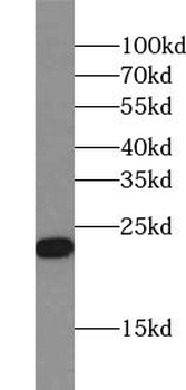 RBP4 Antibody