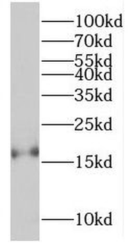 RBP5 Rabbit Polyclonal Antibody