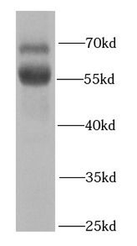 RBPJ Rabbit Polyclonal Antibody