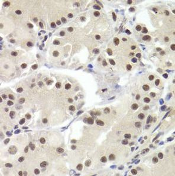 RBPJ Rabbit Polyclonal Antibody