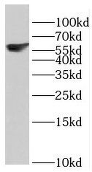 RBPJL Rabbit Polyclonal Antibody