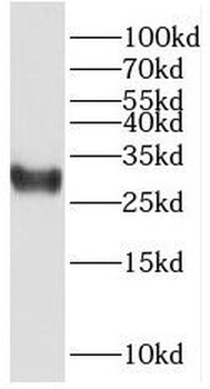 RBPMS Rabbit Polyclonal Antibody