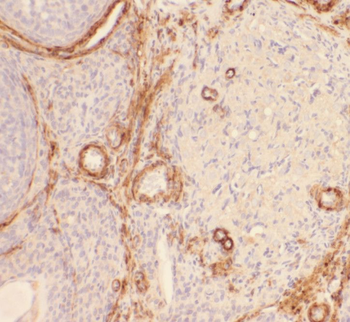 RBPMS Rabbit Polyclonal Antibody