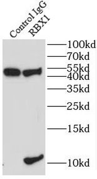 RBX1 Antibody