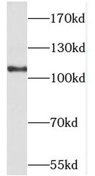 CDH4 Rabbit Polyclonal Antibody
