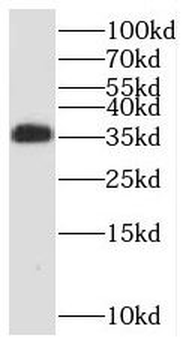 RCBTB1 Rabbit Polyclonal Antibody