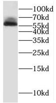RCBTB2 Rabbit Polyclonal Antibody