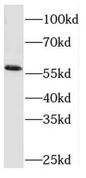 RCOR2 Rabbit Polyclonal Antibody