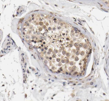 RDM1 Rabbit Polyclonal Antibody